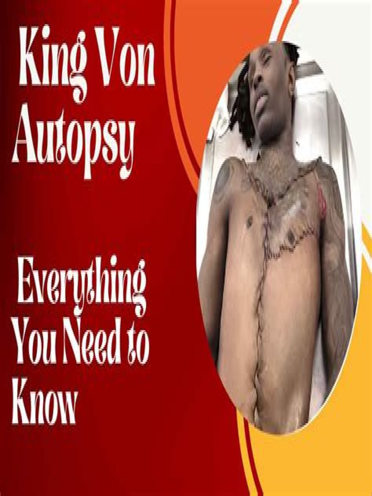 Autopsy Details On King Von's Demise: Uncovering The Tragic Truth