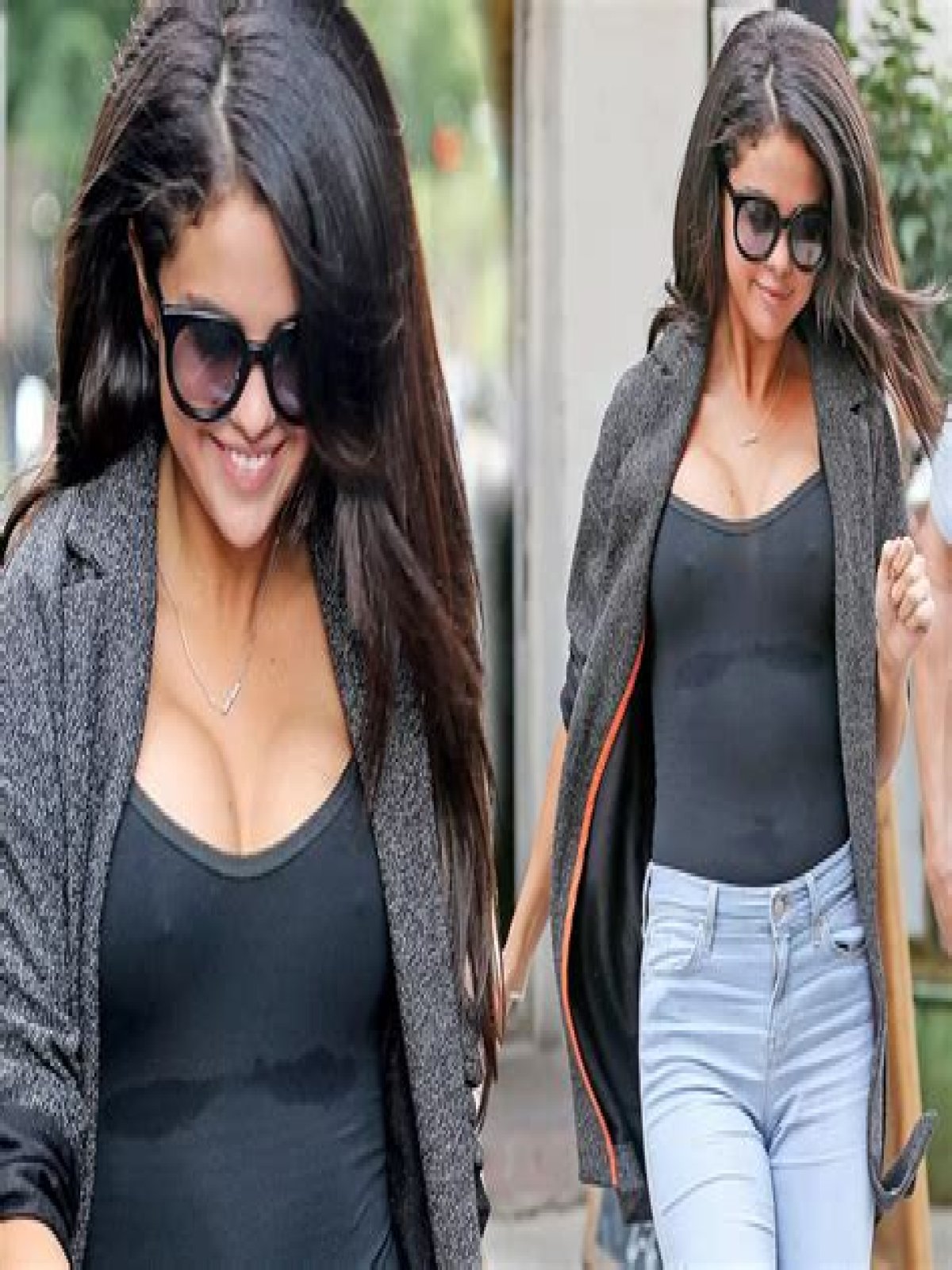 Did Selena Gomez Get a Boob Job? Here’s Why Two Plastic Surgery Experts Think Yes